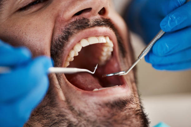 Best Cracked Tooth Emergency Dentist  in Soulsbyville, CA